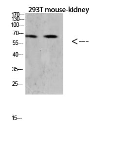 RANK Rabbit Polyclonal Antibody