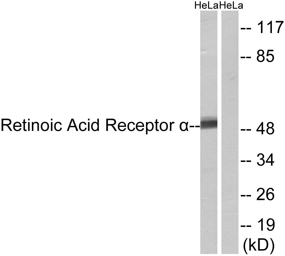 RARα Rabbit Polyclonal Antibody