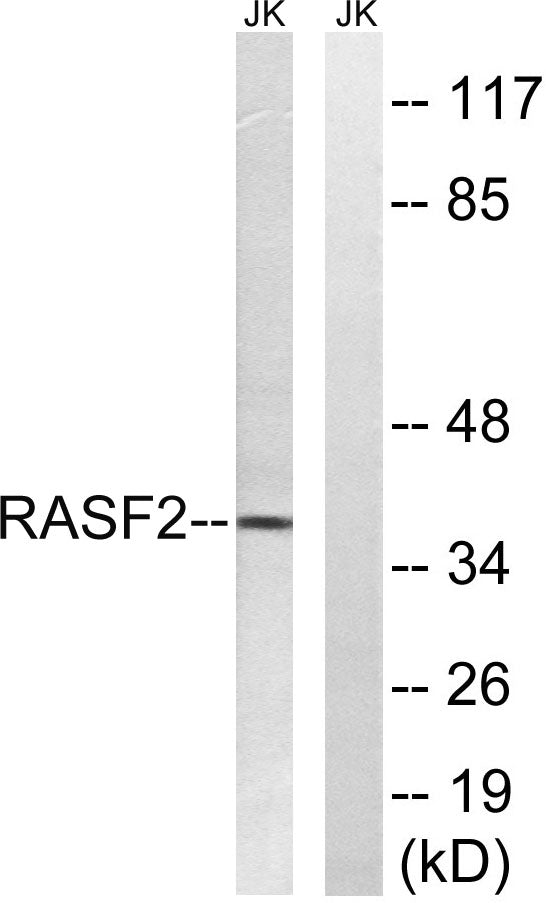 RASSF2 Rabbit Polyclonal Antibody