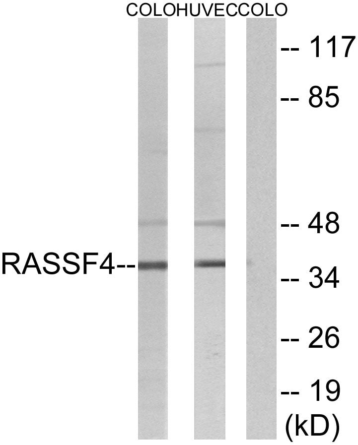 RASSF4 Rabbit Polyclonal Antibody