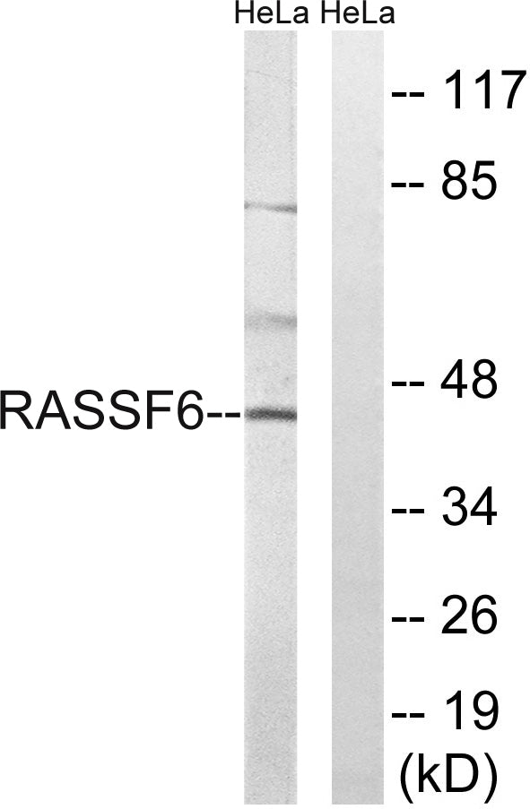 RASSF6 Rabbit Polyclonal Antibody