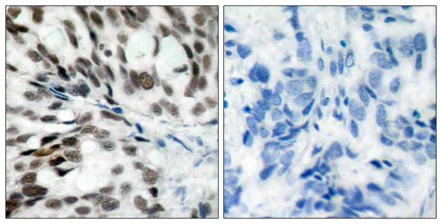 Rb Rabbit Polyclonal Antibody