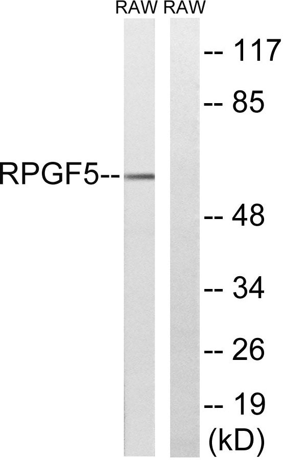 Repac Rabbit Polyclonal Antibody