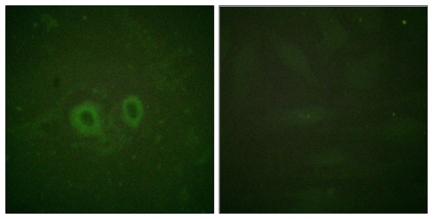 Ret Rabbit Polyclonal Antibody