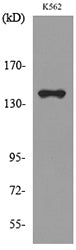 RFC1 Rabbit Polyclonal Antibody