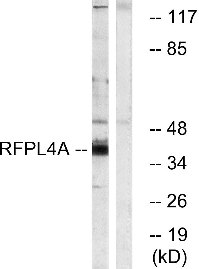 RFPL4A Rabbit Polyclonal Antibody