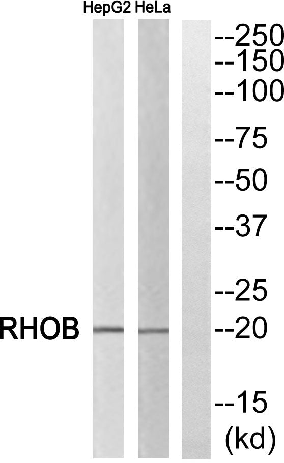 Rho B Rabbit Polyclonal Antibody