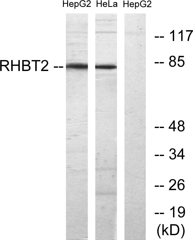 RhoBTB1/2 Rabbit Polyclonal Antibody