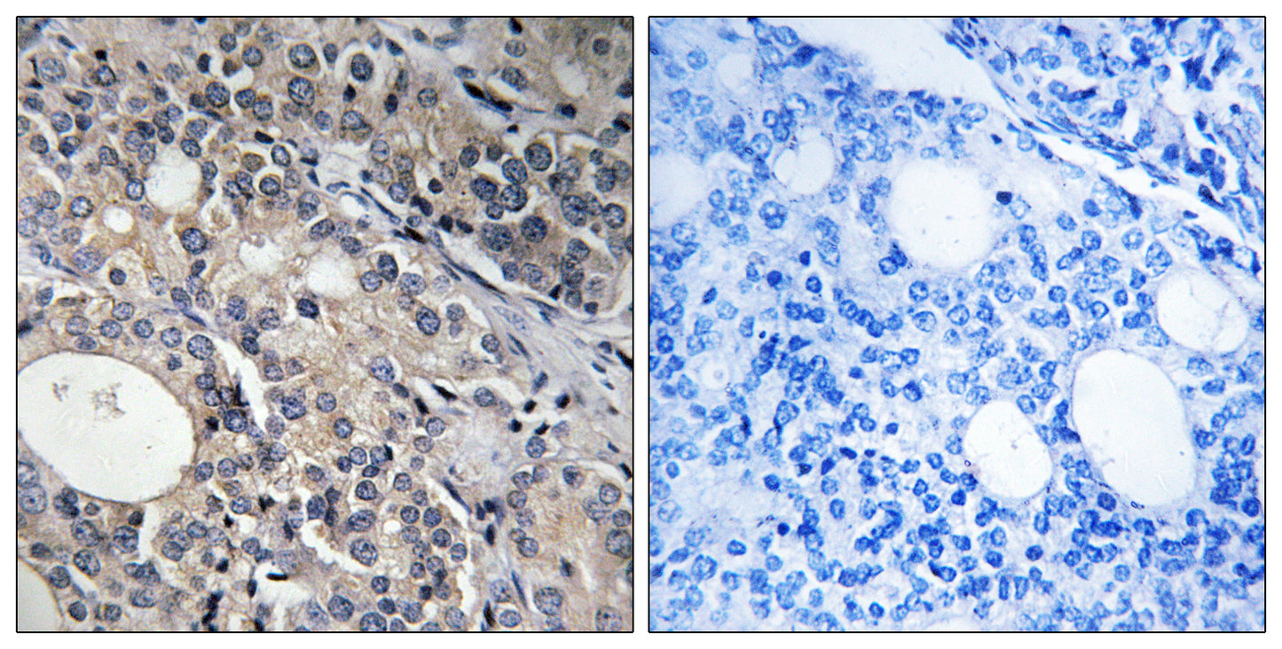 Ribosomal Protein L17 Rabbit Polyclonal Antibody