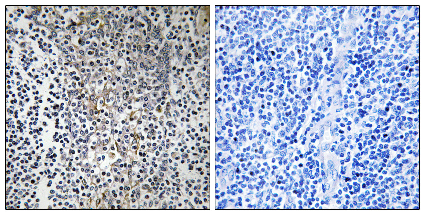 Ribosomal Protein L23 Rabbit Polyclonal Antibody
