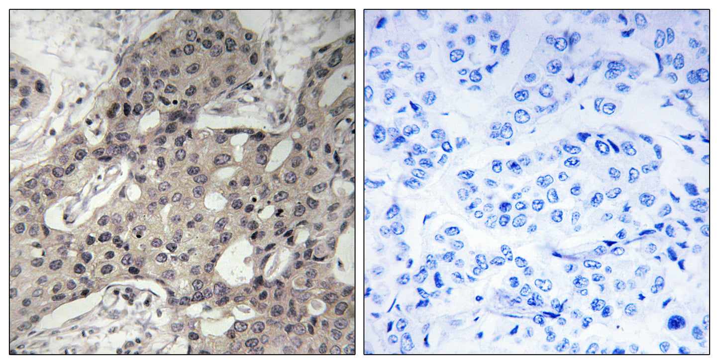 Ribosomal Protein L3 Rabbit Polyclonal Antibody