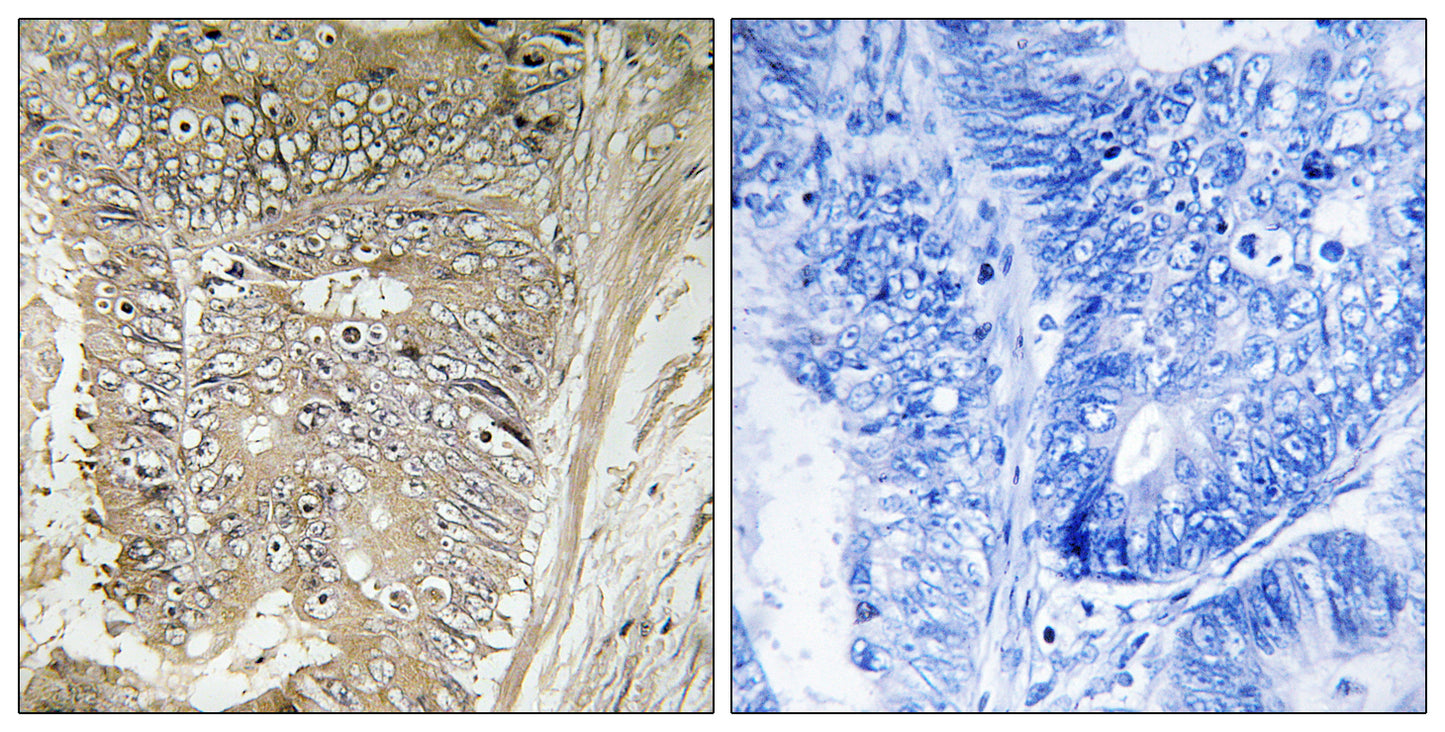 Ribosomal Protein L37A Rabbit Polyclonal Antibody