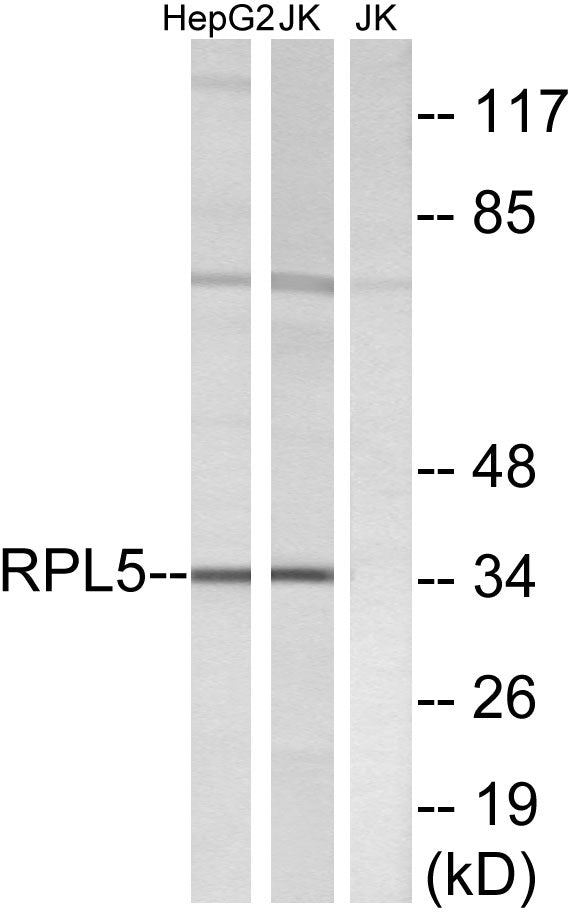 Ribosomal Protein L5 Rabbit Polyclonal Antibody