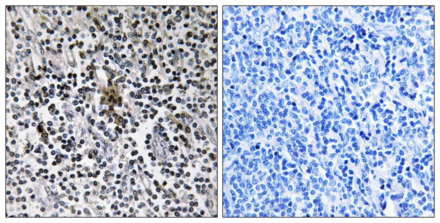 Ribosomal Protein S3 Rabbit Polyclonal Antibody
