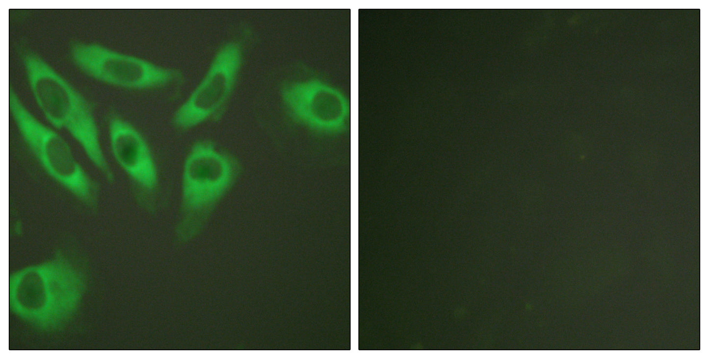 Ribosomal Protein S6 Rabbit Polyclonal Antibody