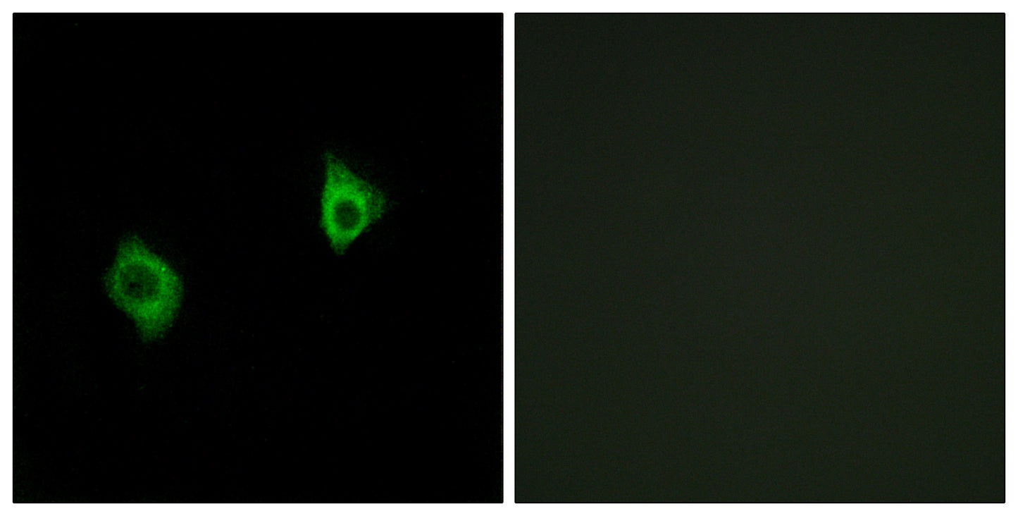 Ribosomal Protein S9 Rabbit Polyclonal Antibody