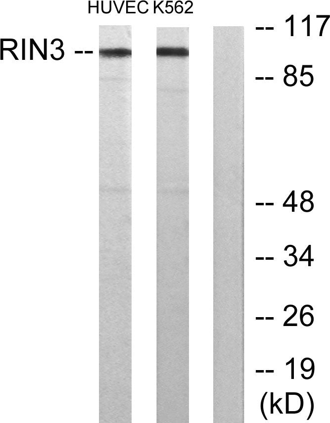 RIN3 Rabbit Polyclonal Antibody