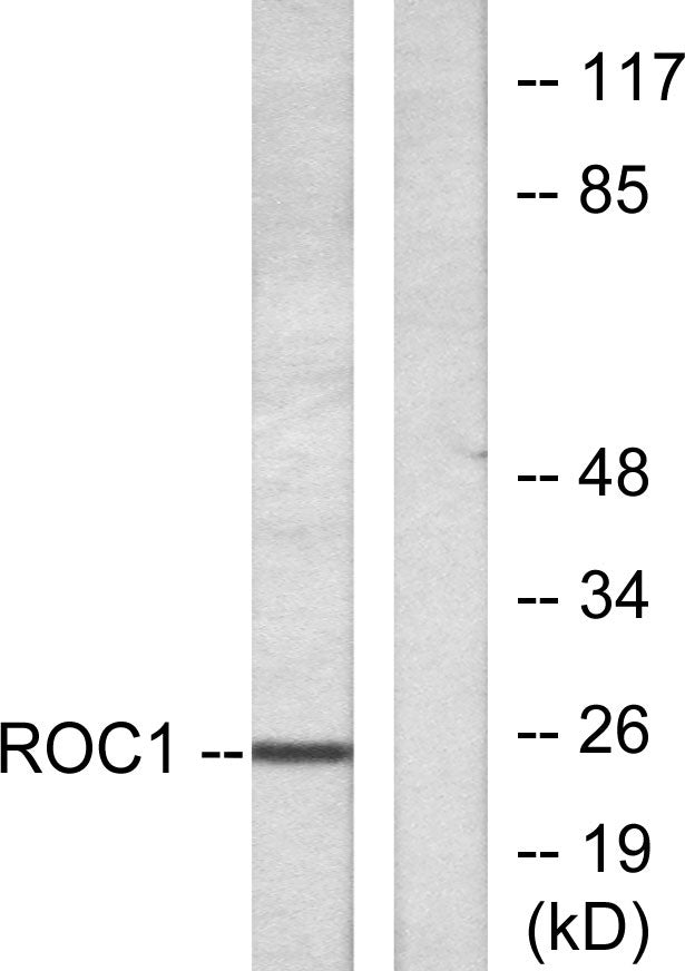 Rit1 Rabbit Polyclonal Antibody