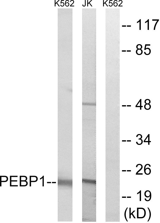 RKIP Rabbit Polyclonal Antibody