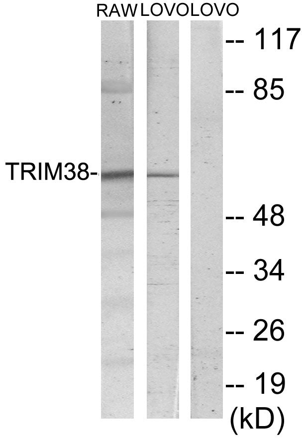 RNF15 Rabbit Polyclonal Antibody
