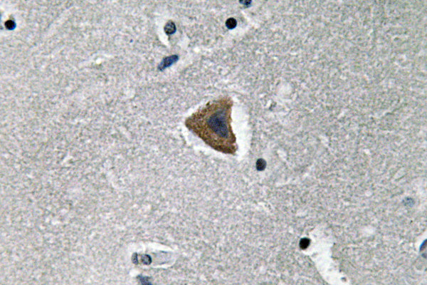 Rock-1 Rabbit Polyclonal Antibody