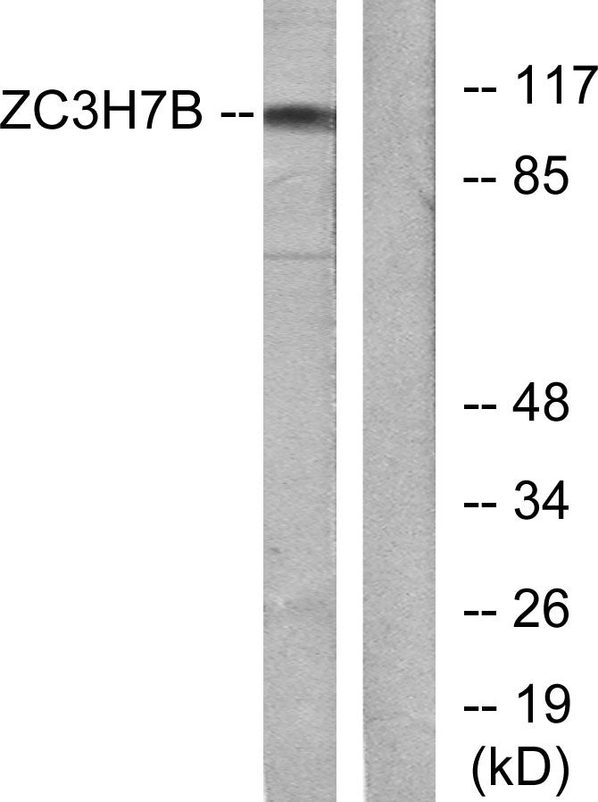 RoXaN Rabbit Polyclonal Antibody