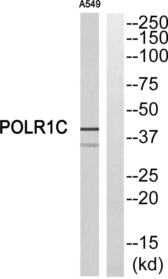 RPA40 Rabbit Polyclonal Antibody