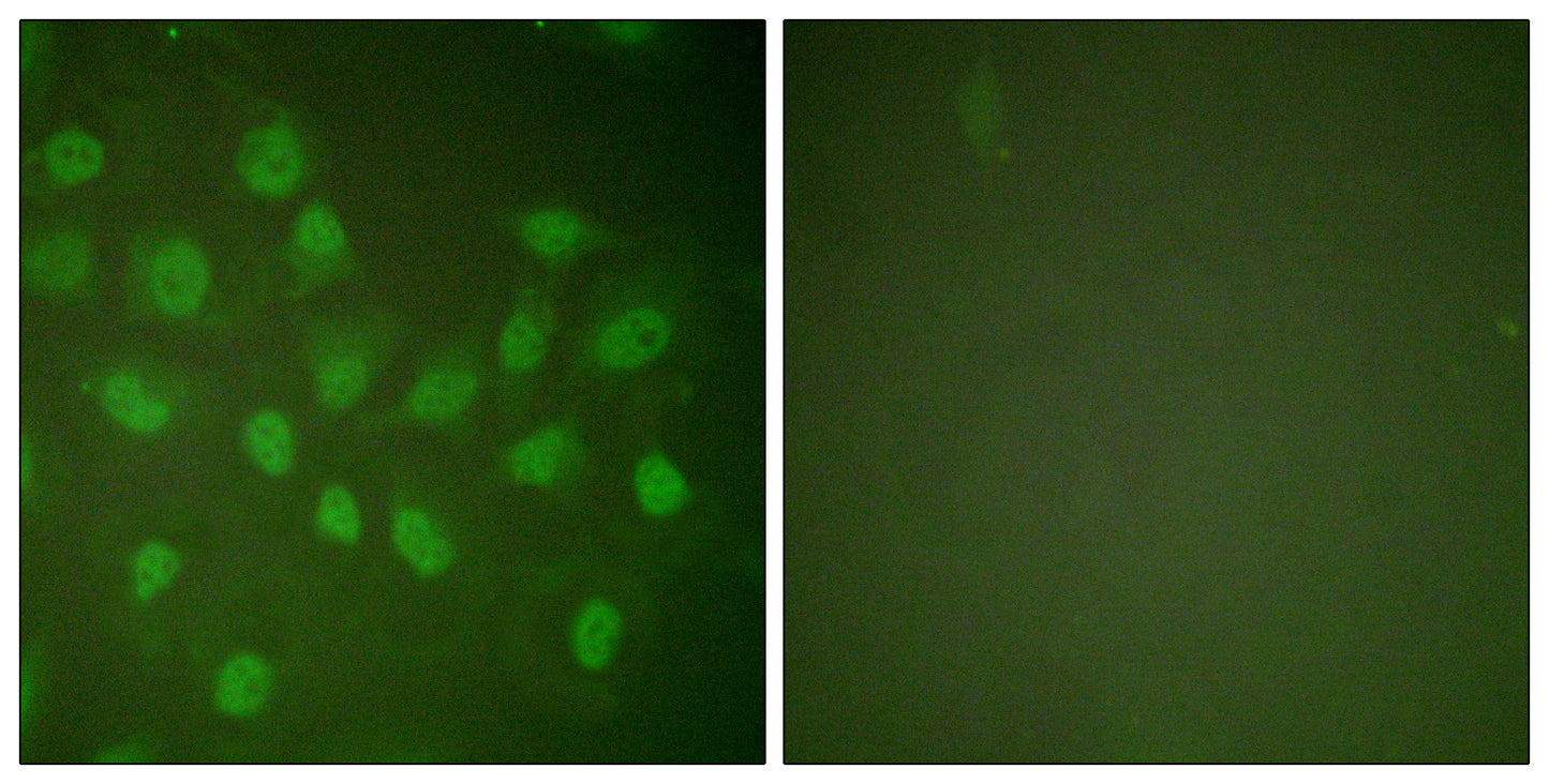 Rpb1 Rabbit Polyclonal Antibody