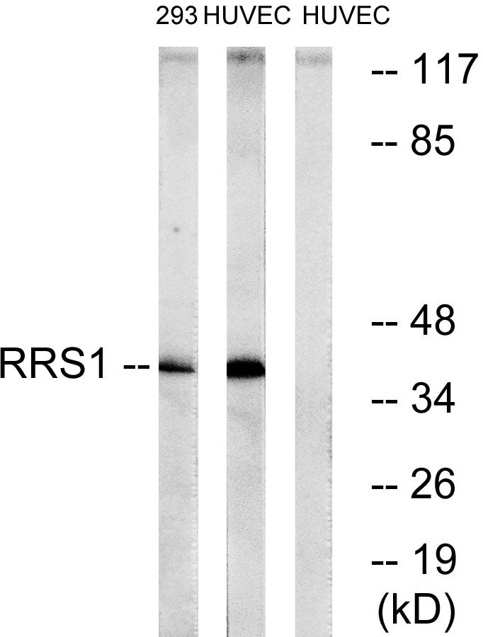 RRS1 Rabbit Polyclonal Antibody