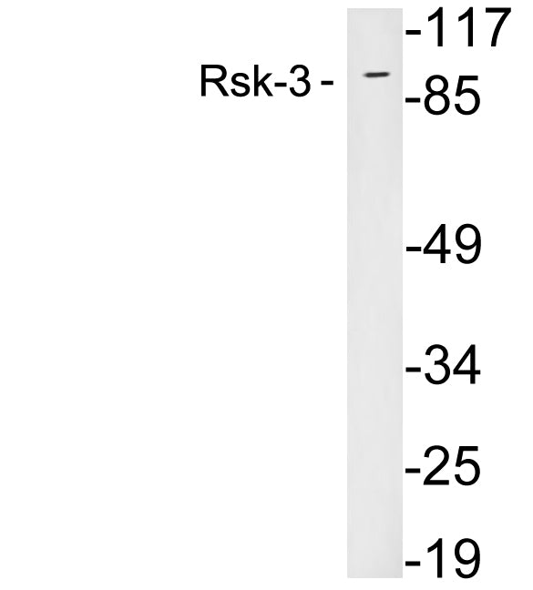 RSK3 Rabbit Polyclonal Antibody