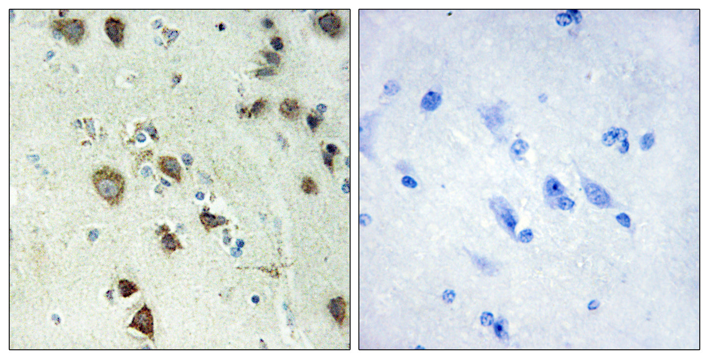 Rsk-4 Rabbit Polyclonal Antibody