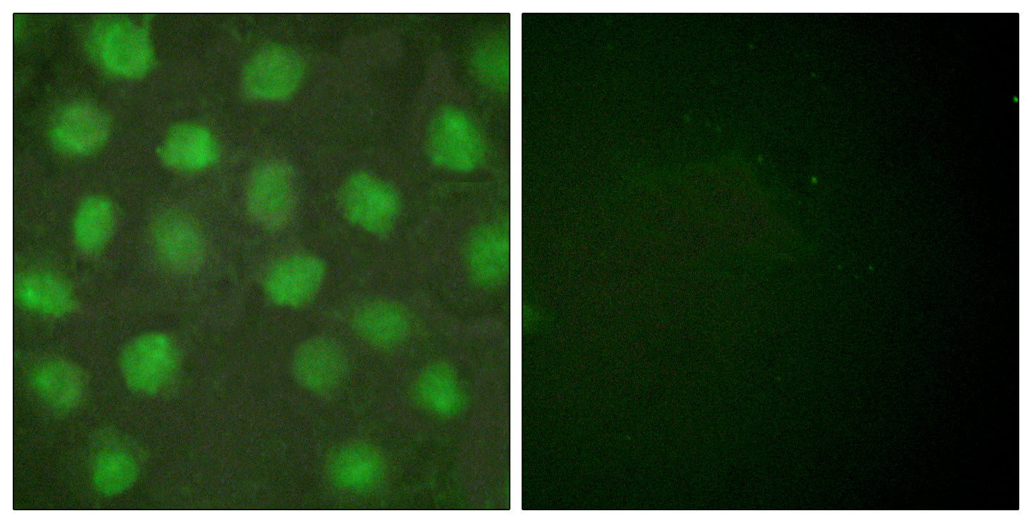 RXRγ Rabbit Polyclonal Antibody