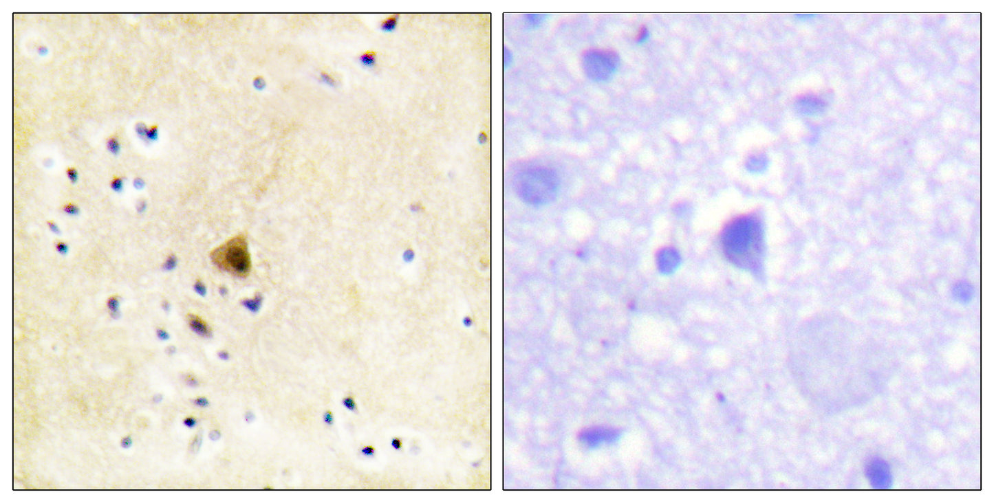 RyR-2 Rabbit Polyclonal Antibody