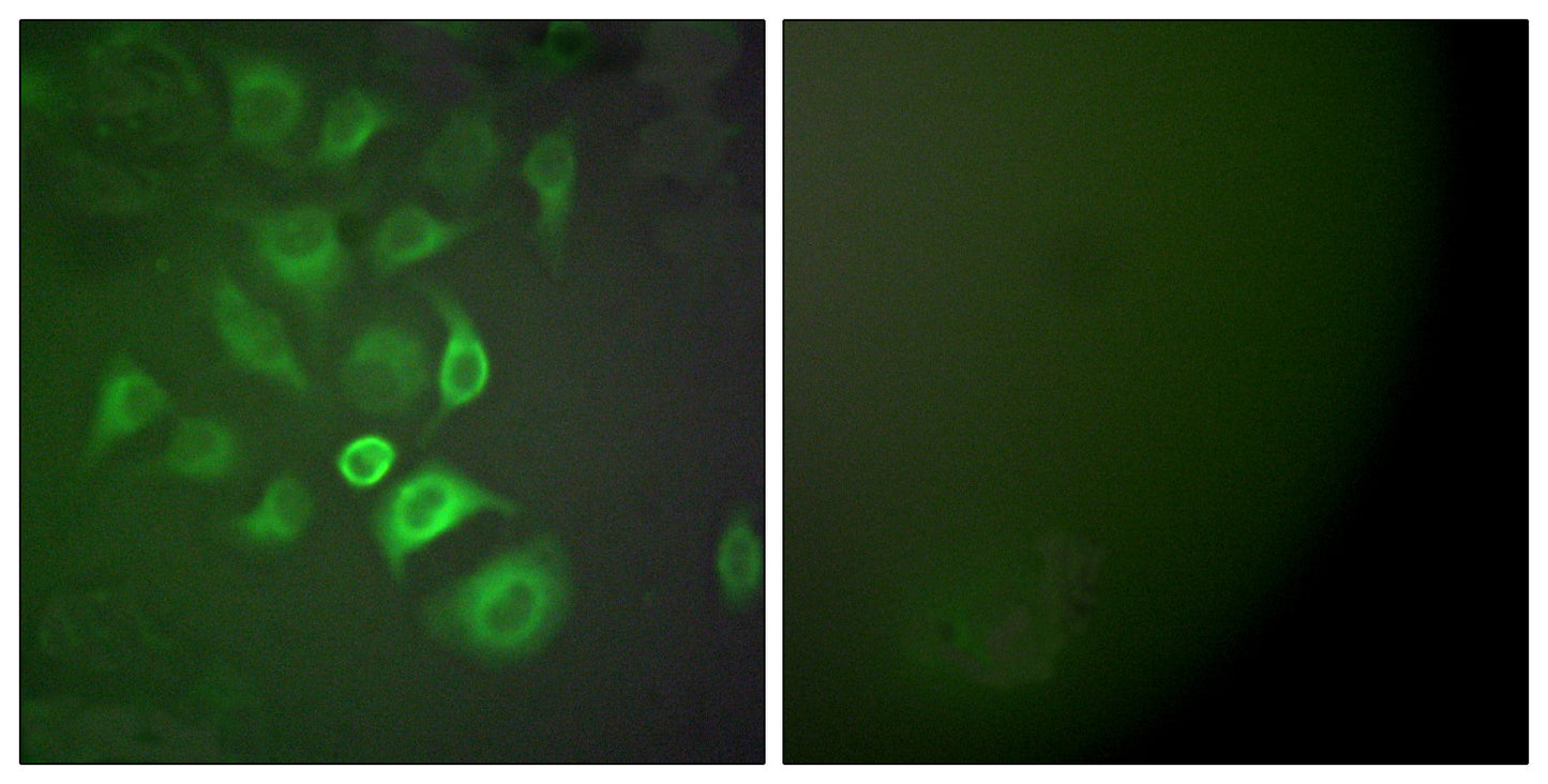 S-100 α Rabbit Polyclonal Antibody