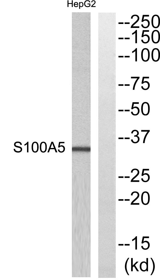 S-100A5 Rabbit Polyclonal Antibody