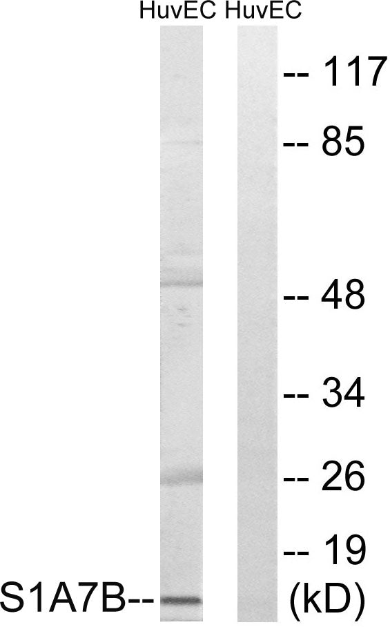 S-100A7L2 Rabbit Polyclonal Antibody