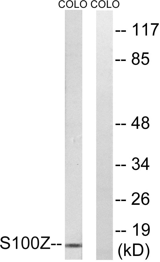 S-100Z Rabbit Polyclonal Antibody