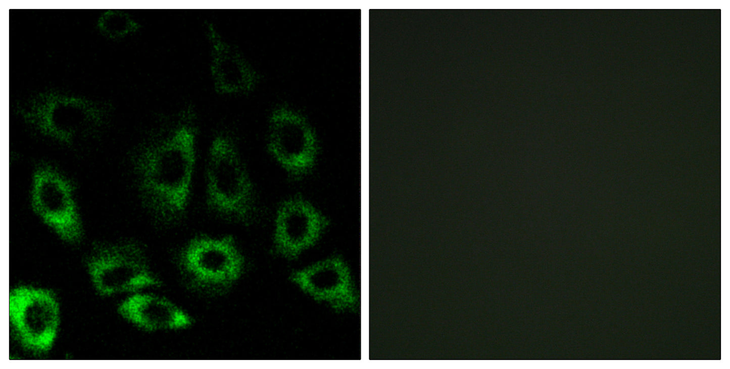 S2P Rabbit Polyclonal Antibody