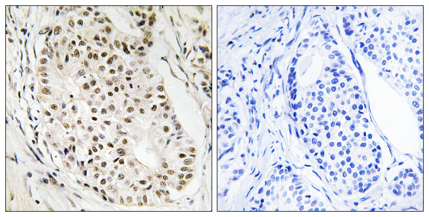 SAF-A2 Rabbit Polyclonal Antibody