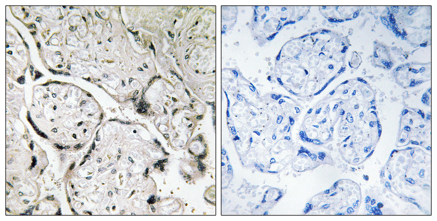Sar1B Rabbit Polyclonal Antibody