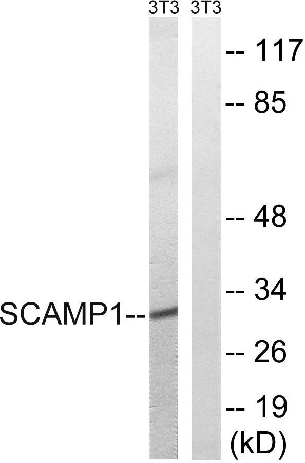 SCAMP1 Rabbit Polyclonal Antibody