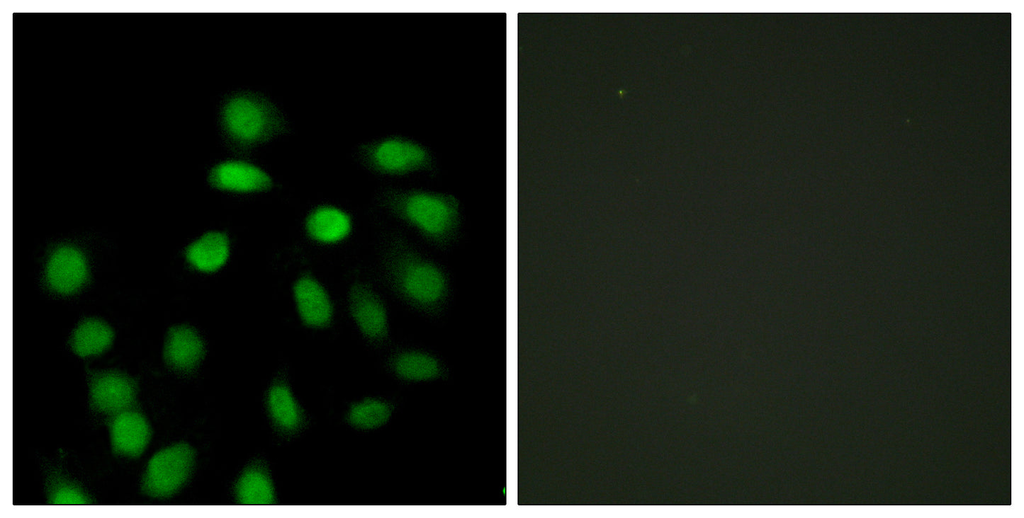 SCAND1 Rabbit Polyclonal Antibody