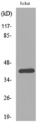 SCCA1/2 Rabbit Polyclonal Antibody