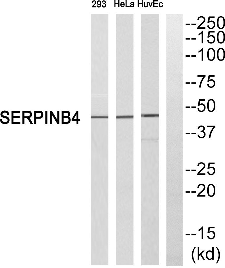 SCCA2 Rabbit Polyclonal Antibody