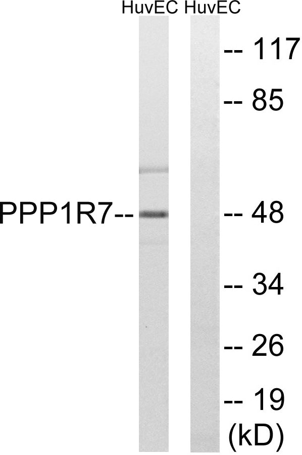 Sds22 Rabbit Polyclonal Antibody