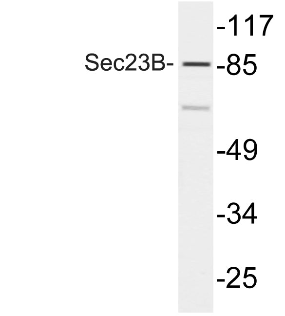 Sec23B Rabbit Polyclonal Antibody