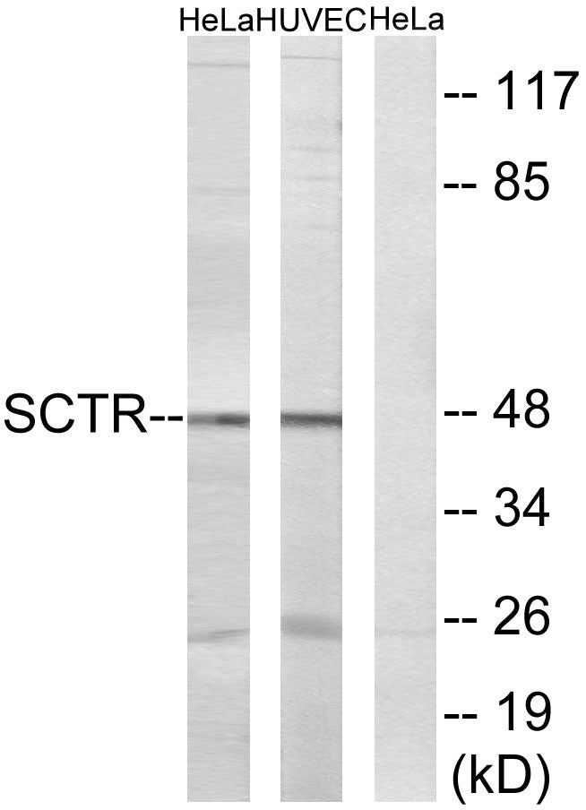 Secretin Receptor Rabbit Polyclonal Antibody