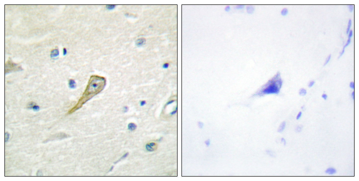 SEMA4A Rabbit Polyclonal Antibody