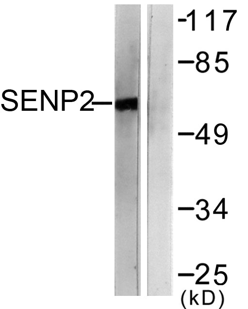 SENP2 Rabbit Polyclonal Antibody