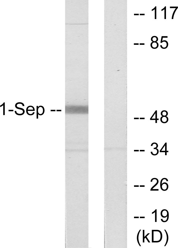 Septin 1 Rabbit Polyclonal Antibody
